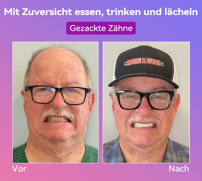 𝐉𝐚𝐬𝐬𝐞𝐞𝐦® Neueste Premium-Komfort-Zahnersätze🎉 (Hochwertige Zahnersätze, Bequem zu Tragen - 70% Rabatt für begrenzte Zeit)🔥