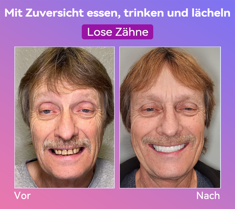 𝐉𝐚𝐬𝐬𝐞𝐞𝐦® Neueste Premium-Komfort-Zahnersätze🎁(Hochwertige Zahnersätze, Bequem zu Tragen - 70% Rabatt für begrenzte Zeit)