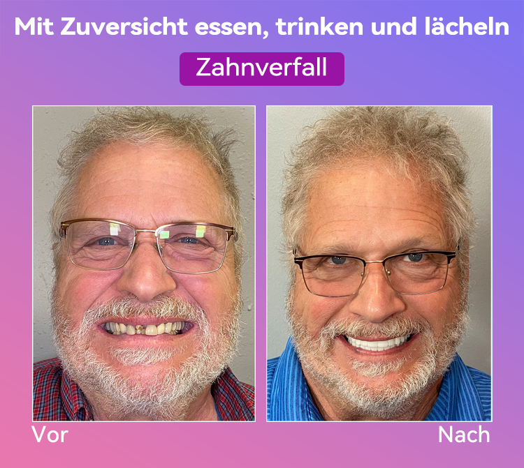 𝐉𝐚𝐬𝐬𝐞𝐞𝐦® Neueste Premium-Komfort-Zahnersätze🎁(Hochwertige Zahnersätze, Bequem zu Tragen - 70% Rabatt für begrenzte Zeit)