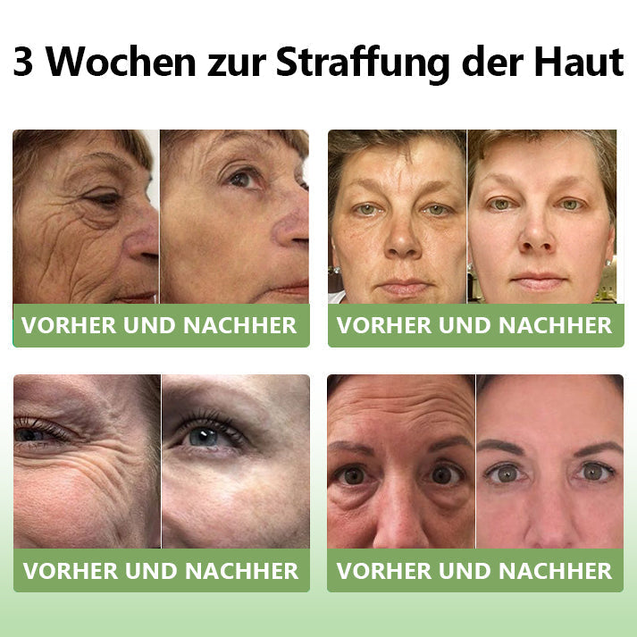 (Offizieller Shop) STDEI®  Natürliche Kollagen-Firming-Creme 🎁🎁