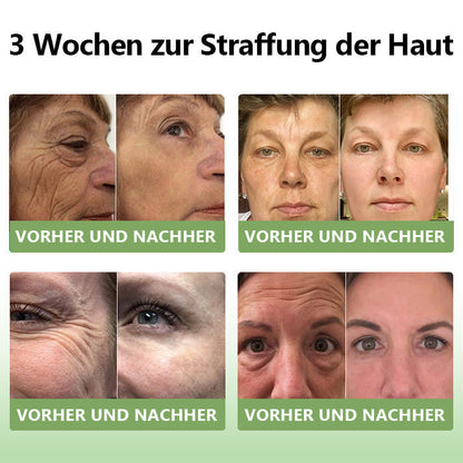 (Offizieller Shop) STDEI®  Natürliche Kollagen-Firming-Creme 🎁🎁