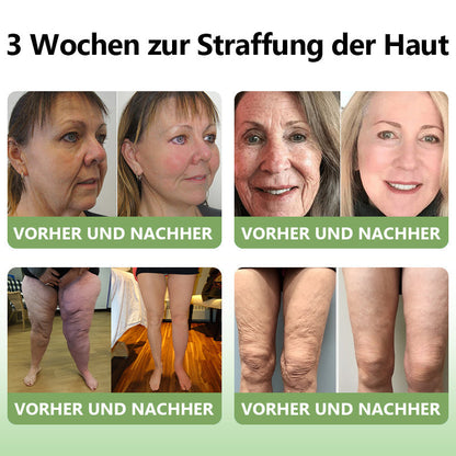 (Offizieller Shop) STDEI®  Natürliche Kollagen-Firming-Creme 🎁🎁