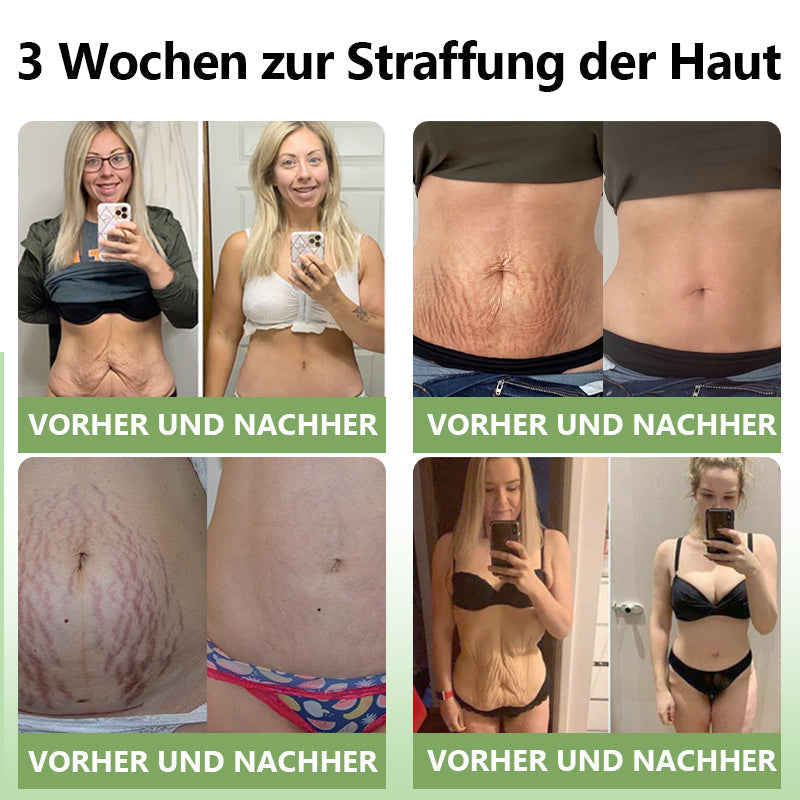 (Offizieller Shop) STDEI®  Natürliche Kollagen-Firming-Creme 🎁🎁