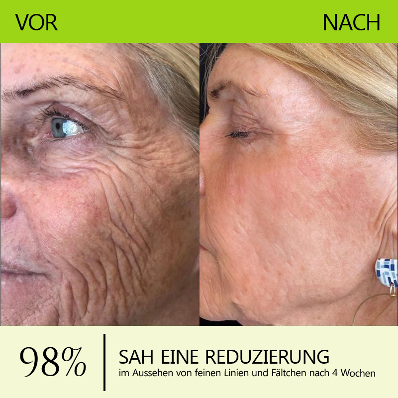 （Offizieller Store）💫 STDEI® Botox & Vitamin-A-Retinol Shot Anti-Falten Straffungscreme - Jetzt 50% im Jahresendverkauf!🔥