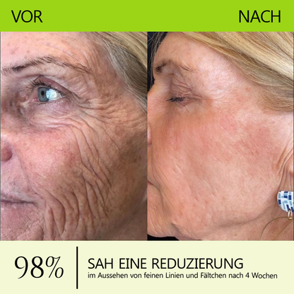 （Offizieller Store）💫 STDEI® Botox & Vitamin-A-Retinol Shot Anti-Falten Straffungscreme - Jetzt 50% im Jahresendverkauf!🔥