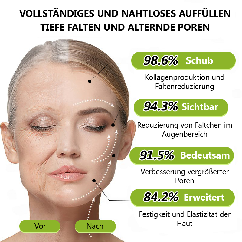 （Offizieller Store）💫 STDEI® Botox & Vitamin-A-Retinol Shot Anti-Falten Straffungscreme - Jetzt 50% im Jahresendverkauf!🔥
