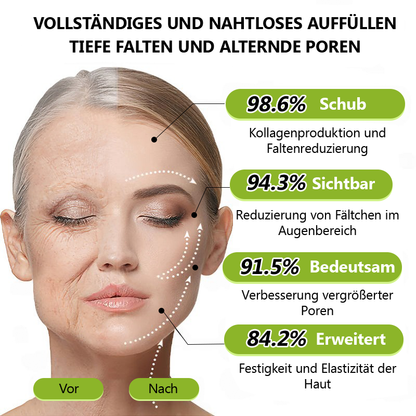 （Offizieller Store）💫 STDEI® Botox & Vitamin-A-Retinol Shot Anti-Falten Straffungscreme - Jetzt 50% im Jahresendverkauf!🔥