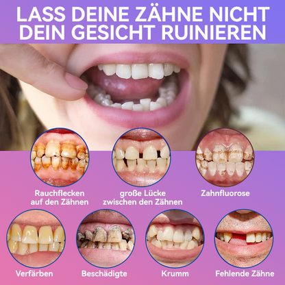 𝐉𝐚𝐬𝐬𝐞𝐞𝐦® Neueste Premium-Komfort-Zahnersätze🎉 (Hochwertige Zahnersätze, Bequem zu Tragen - 70% Rabatt für begrenzte Zeit)🔥