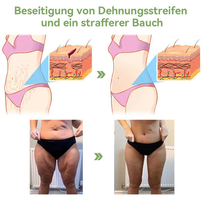 (Offizieller Shop) STDEI®  Natürliche Kollagen-Firming-Creme 🎁🎁
