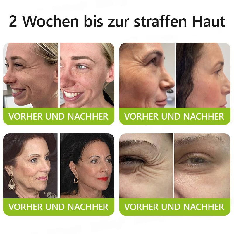 （Offizieller Store）💫 STDEI® Botox & Vitamin-A-Retinol Shot Anti-Falten Straffungscreme - Jetzt 50% im Jahresendverkauf!🔥