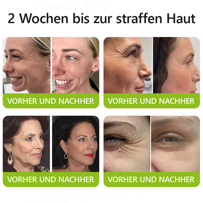 （Offizieller Store）💫 STDEI® Botox & Vitamin-A-Retinol Shot Anti-Falten Straffungscreme - Jetzt 50% im Jahresendverkauf!🔥