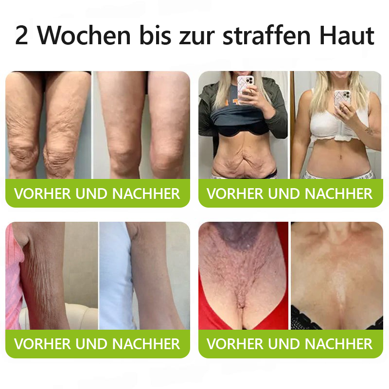 （Offizieller Store）💫 STDEI® Botox & Vitamin-A-Retinol Shot Anti-Falten Straffungscreme - Jetzt 50% im Jahresendverkauf!🔥
