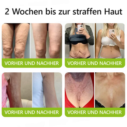 （Offizieller Store）💫 STDEI® Botox & Vitamin-A-Retinol Shot Anti-Falten Straffungscreme - Jetzt 50% im Jahresendverkauf!🔥
