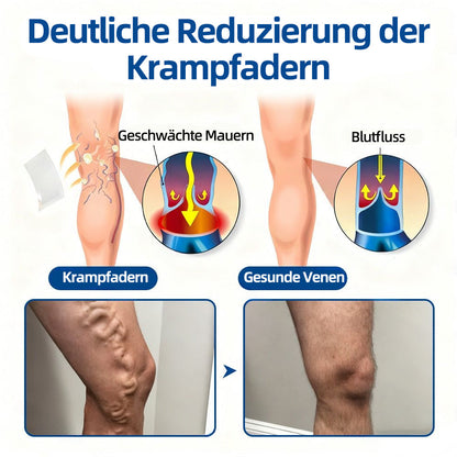 👩‍⚕️🎁𝐅𝐥𝐨𝐫𝐢𝐬𝐦𝐚®✅𝐕𝐞𝐧𝐞𝐧-𝐙𝐢𝐞𝐥 𝐌𝐢𝐤𝐫𝐨𝐧𝐚𝐝𝐞𝐥𝐩𝐟𝐥𝐚𝐬𝐭𝐞𝐫⚡Sofortige Linderung, langfristige Ergebnisse
