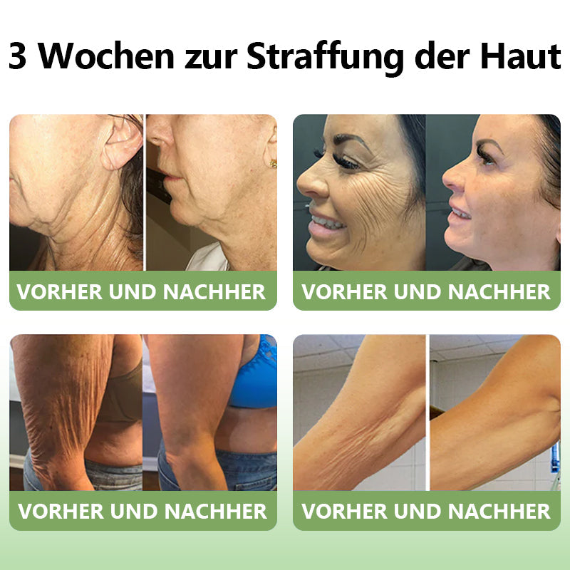 (Offizieller Shop) STDEI®  Natürliche Kollagen-Firming-Creme 🎁🎁