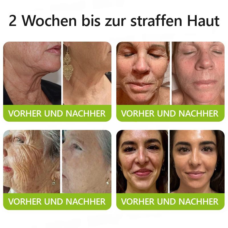 （Offizieller Store）💫 STDEI® Botox & Vitamin-A-Retinol Shot Anti-Falten Straffungscreme - Jetzt 50% im Jahresendverkauf!🔥