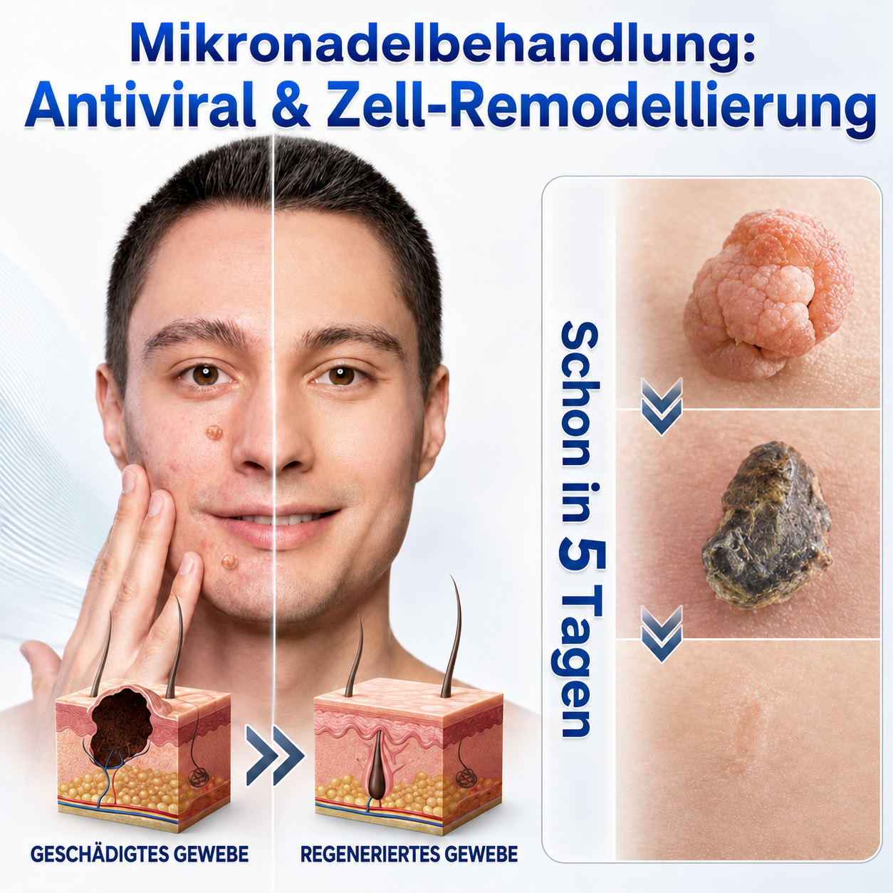 👩‍⚕️🎁 𝑶𝒇𝒇𝒊𝒛𝒊𝒆𝒍𝒍𝒆𝒓 𝑺𝒕𝒐𝒓𝒆 | 𝑵𝐞𝒌𝐢𝐬𝐬® 🌿 𝑴𝒊𝒌𝒓𝒐𝒏𝒂𝒅𝒆𝒍𝒏 𝑴𝒂𝒌𝒆𝒍𝒍𝒐𝒔𝒆 𝑯𝒂𝒖𝒕 𝑯𝒂𝒖𝒕 𝑾𝒂𝒓𝒛𝒆 𝑬𝒏𝒕𝒇𝒆𝒓𝒏𝒖𝒏𝒈 𝑷𝒇𝒍𝒂𝒔𝒕𝒆𝒓 (𝐹ü𝑟 𝐻𝑎𝑢𝑡𝑎𝑛ℎä𝑛𝑔𝑠𝑒𝑙, 𝑘𝑙𝑒𝑖𝑛𝑒 𝐻𝑎𝑢𝑡𝑤𝑢𝑐ℎ𝑒𝑟𝑢𝑛𝑔𝑒𝑛, 𝑊𝑎𝑟𝑧𝑒𝑛, 𝑀𝑢𝑡𝑡𝑒𝑟𝑚𝑎𝑙𝑒, 𝐴𝑙𝑡𝑒𝑟𝑠𝑓𝑙𝑒𝑐𝑘𝑒𝑛 𝑢𝑛𝑑 𝑃𝑖𝑔𝑚𝑒𝑛𝑡𝑠𝑡ö𝑟𝑢𝑛𝑔𝑒𝑛.)