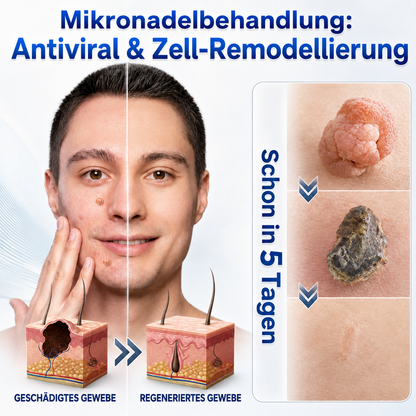 👩‍⚕️🎁 𝑶𝒇𝒇𝒊𝒛𝒊𝒆𝒍𝒍𝒆𝒓 𝑺𝒕𝒐𝒓𝒆 | 𝑵𝐞𝒌𝐢𝐬𝐬® 🌿 𝑴𝒊𝒌𝒓𝒐𝒏𝒂𝒅𝒆𝒍𝒏 𝑴𝒂𝒌𝒆𝒍𝒍𝒐𝒔𝒆 𝑯𝒂𝒖𝒕 𝑯𝒂𝒖𝒕 𝑾𝒂𝒓𝒛𝒆 𝑬𝒏𝒕𝒇𝒆𝒓𝒏𝒖𝒏𝒈 𝑷𝒇𝒍𝒂𝒔𝒕𝒆𝒓 (𝐹ü𝑟 𝐻𝑎𝑢𝑡𝑎𝑛ℎä𝑛𝑔𝑠𝑒𝑙, 𝑘𝑙𝑒𝑖𝑛𝑒 𝐻𝑎𝑢𝑡𝑤𝑢𝑐ℎ𝑒𝑟𝑢𝑛𝑔𝑒𝑛, 𝑊𝑎𝑟𝑧𝑒𝑛, 𝑀𝑢𝑡𝑡𝑒𝑟𝑚𝑎𝑙𝑒, 𝐴𝑙𝑡𝑒𝑟𝑠𝑓𝑙𝑒𝑐𝑘𝑒𝑛 𝑢𝑛𝑑 𝑃𝑖𝑔𝑚𝑒𝑛𝑡𝑠𝑡ö𝑟𝑢𝑛𝑔𝑒𝑛.)
